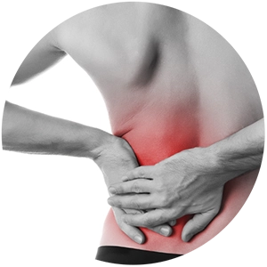 Sciatica